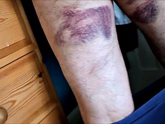 Caned by his wife