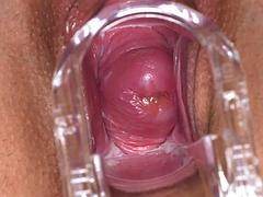 Fetisj, Gynaecoloog, Masturbatie, Alleen
