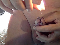 wax in the urethra